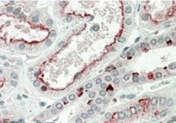 MK5/MAPKAPK5 Antibody
