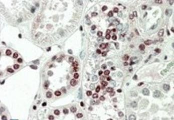 MK5/MAPKAPK5 (aa192-206) Antibody