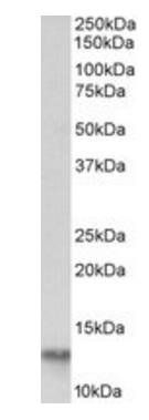 FABP4 Antibody