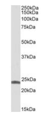 TNNI1 Antibody