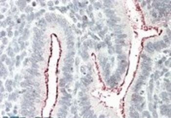 BCAR1 Antibody