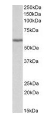 Fibrinogen Beta Chain (aa 177-190) Goat Polyclonal Antibody