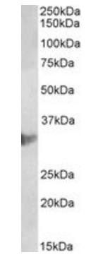 CLIC1/NCC27 (aa45-57) Antibody