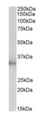 CLIC1/NCC27 Antibody
