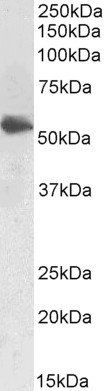 LCAT (aa366-378) Antibody