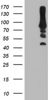 MAPRE2 Antibody
