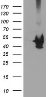 MAPRE2 Antibody