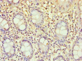 ECE2 Antibody