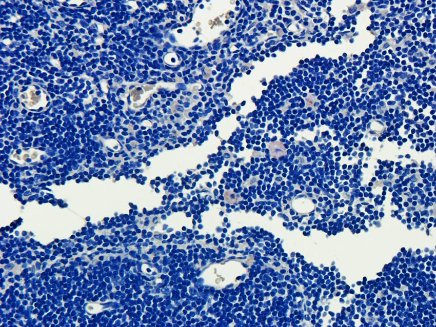 ECP Rabbit Polyclonal Antibody
