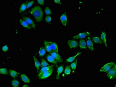 EDNRB Antibody