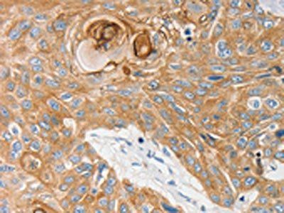 EDNRB Antibody