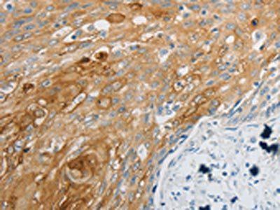 EDNRB Antibody