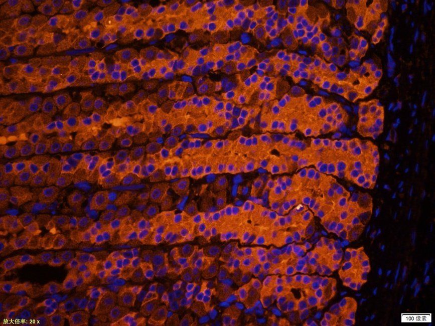 eEF2 Rabbit Polyclonal Antibody