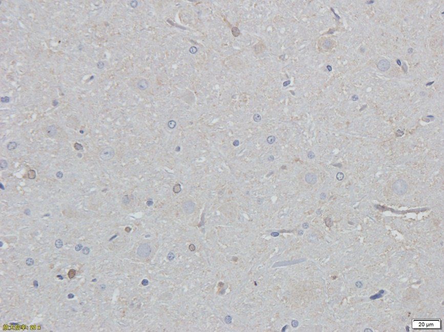 eEF2 Rabbit Polyclonal Antibody