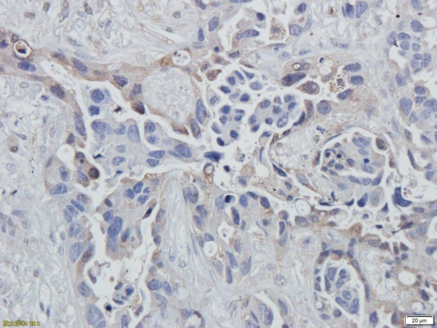 eEF2 Rabbit Polyclonal Antibody