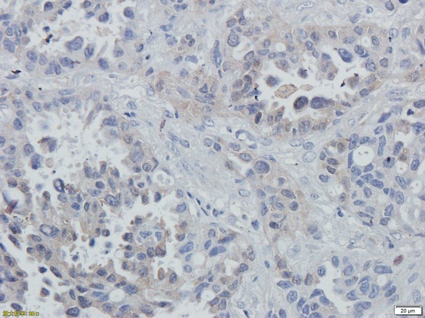 eEF2 Rabbit Polyclonal Antibody