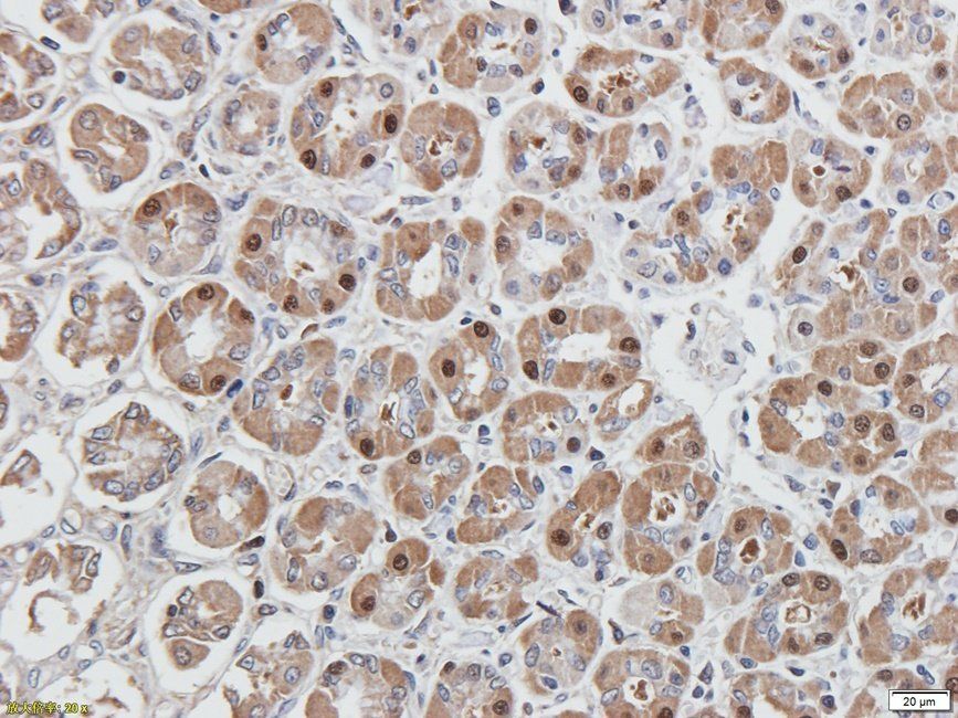 eEF2 Rabbit Polyclonal Antibody