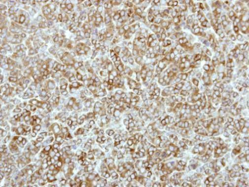eEF2K Rabbit Polyclonal Antibody