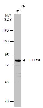 eEF2K Rabbit Polyclonal Antibody