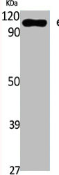 EEF2K Antibody