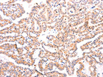 EFNA1 Antibody