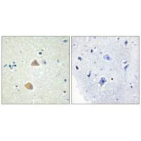 EFNA5 Antibody