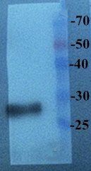 EGFP Rabbit Polyclonal Antibody