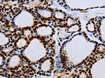 EGFR Antibody