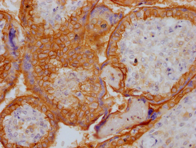 EGFR Antibody