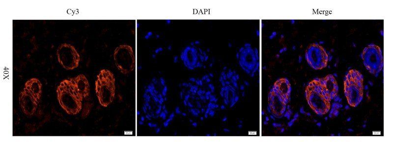 EGFR isoform a variant Rabbit Polyclonal Antibody
