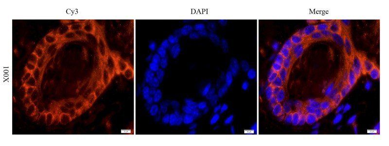 EGFR isoform a variant Rabbit Polyclonal Antibody