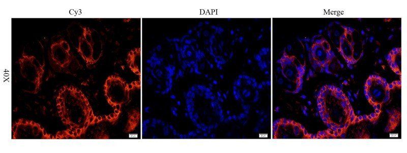 EGFR isoform a variant Rabbit Polyclonal Antibody