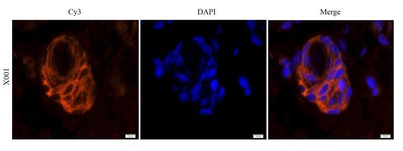EGFR isoform a variant Rabbit Polyclonal Antibody