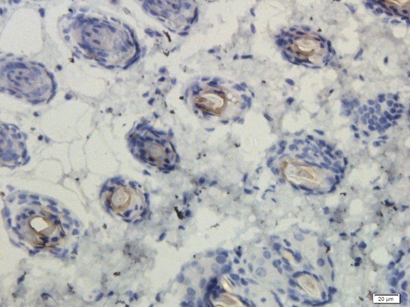 EGFR isoform a variant Rabbit Polyclonal Antibody
