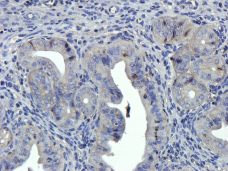 EGFR isoform a variant Rabbit Polyclonal Antibody