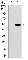 EGFR mutant Antibody
