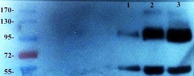 EGFRvIII Rabbit Polyclonal Antibody