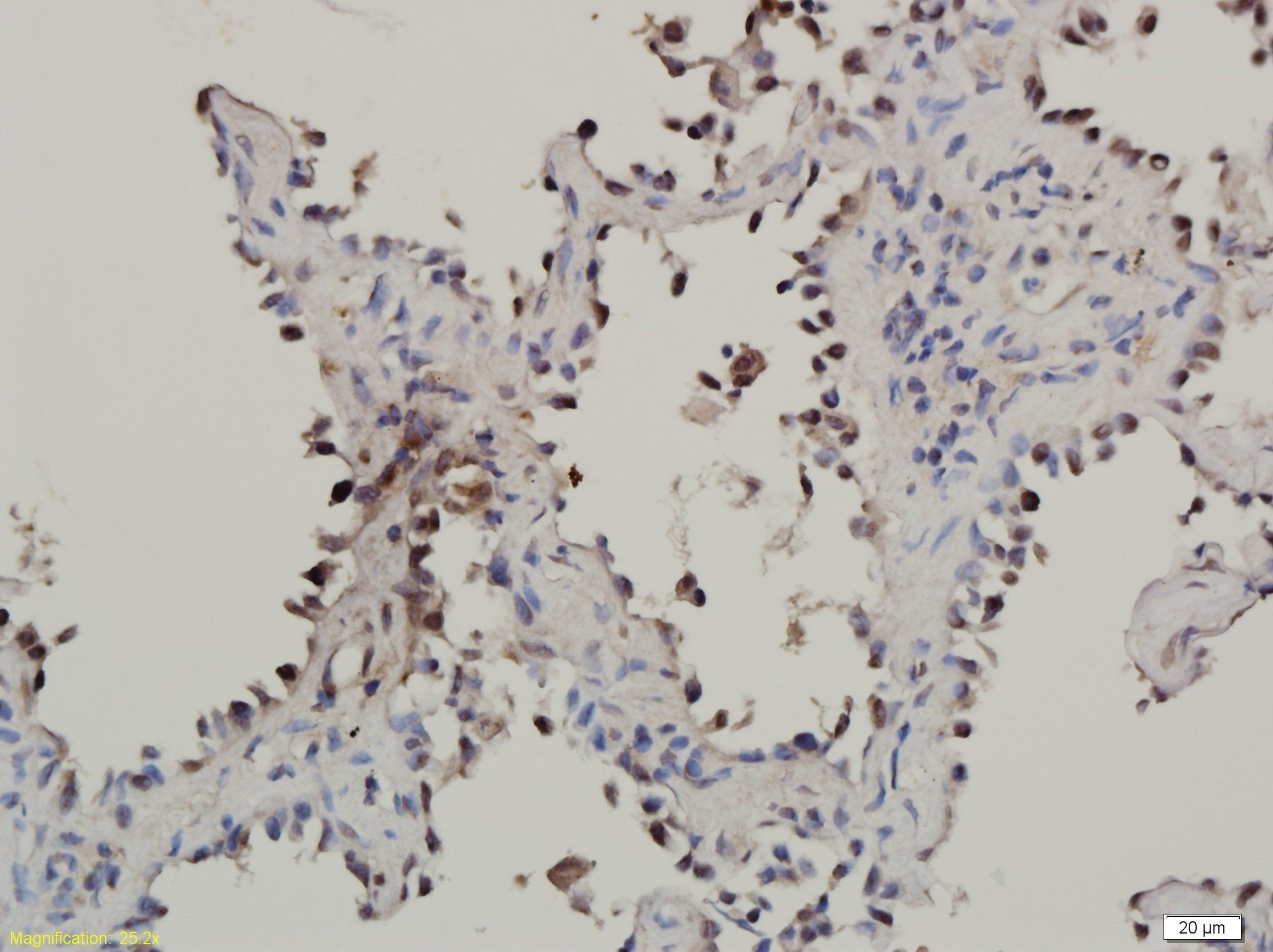 EGFRvIII Rabbit Polyclonal Antibody