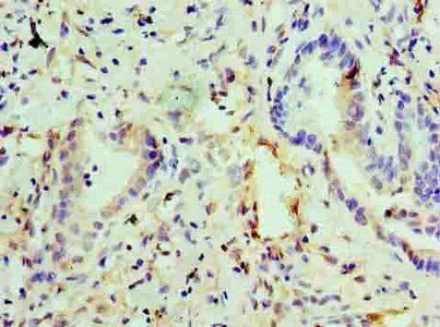 EGLN2 Antibody