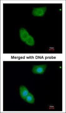 EHBP1 Rabbit Polyclonal Antibody