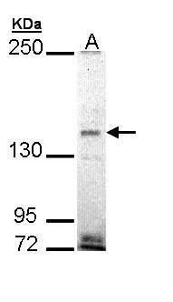 EHBP1 Rabbit Polyclonal Antibody