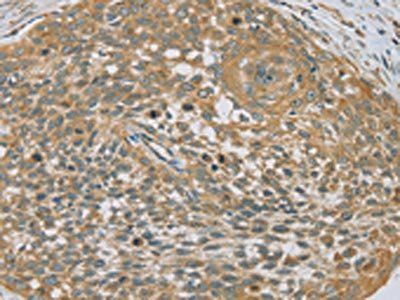 EHHADH Antibody