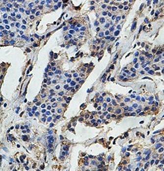 EIF3D Rabbit Polyclonal Antibody