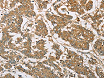 EIF3F Antibody
