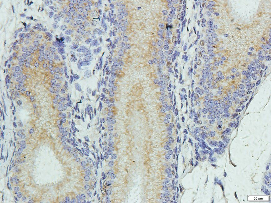 Elastin Rabbit Polyclonal Antibody