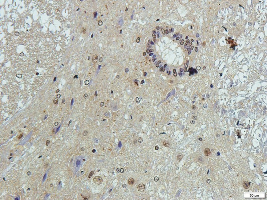 Elastin Rabbit Polyclonal Antibody