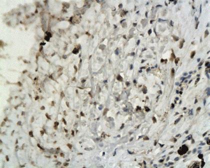 Elastin Rabbit Polyclonal Antibody