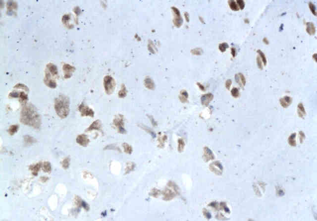 Elastin Rabbit Polyclonal Antibody