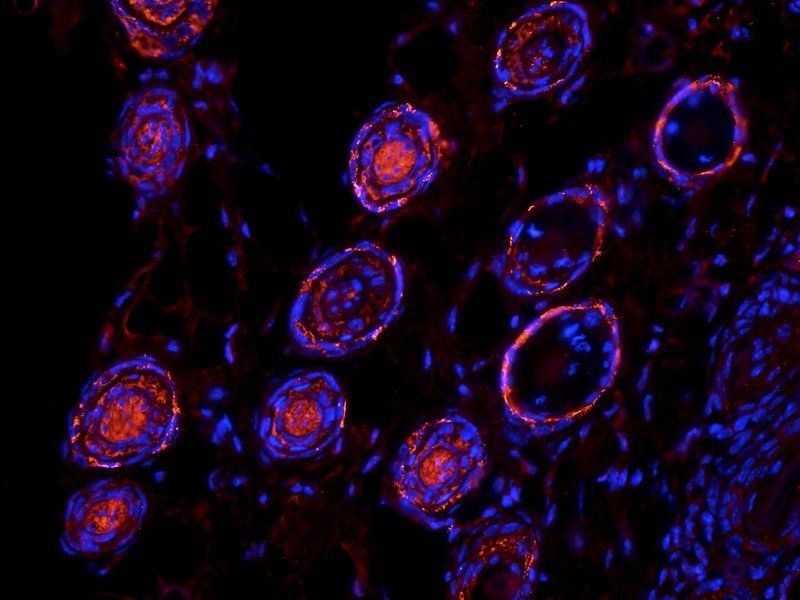 Elastin Rabbit Polyclonal Antibody