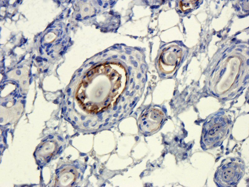 Elastin Rabbit Polyclonal Antibody